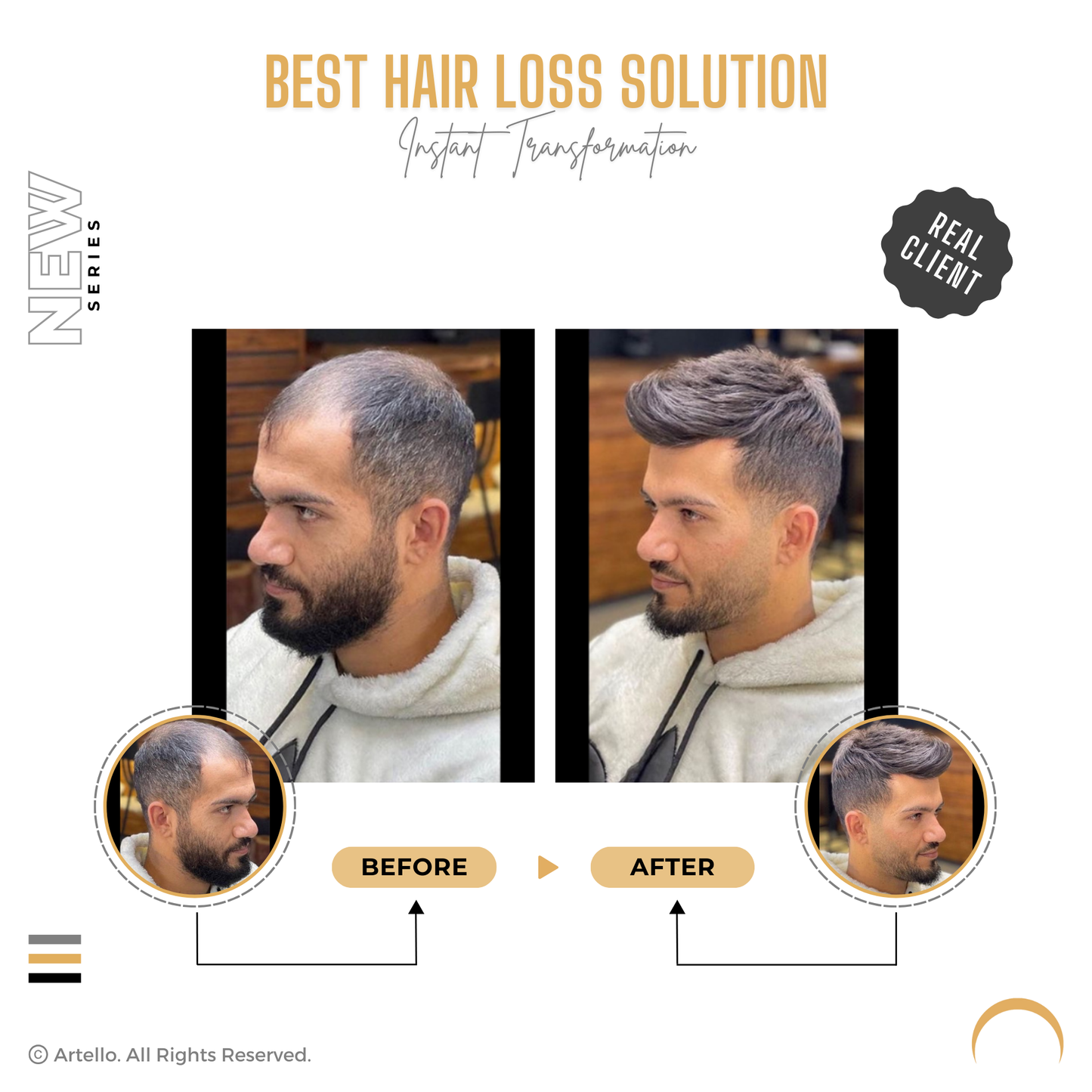 Artello PREMIUM MONO Smart Hair Patch for Men